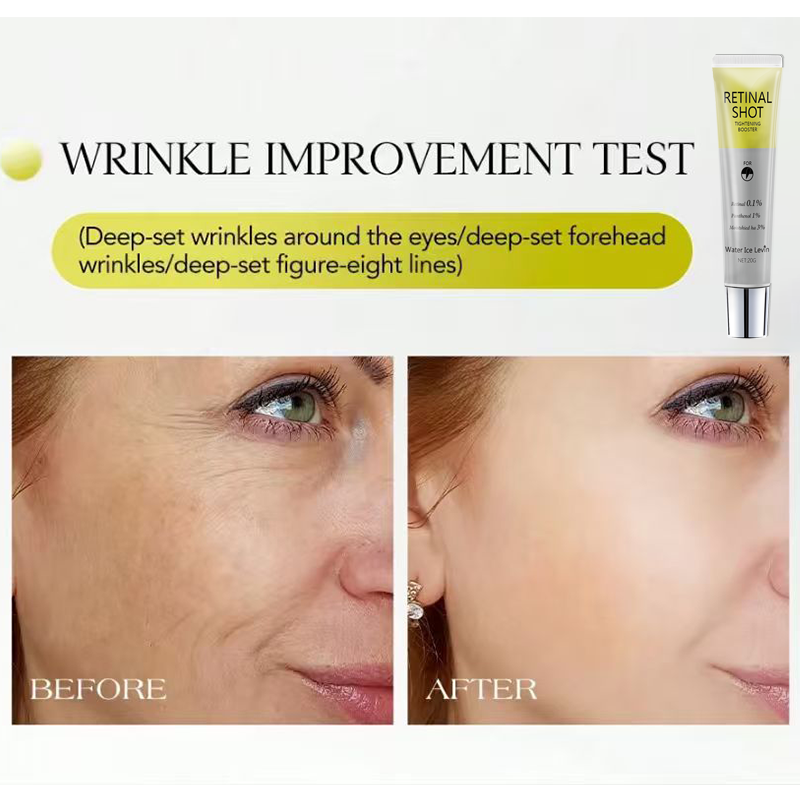 Retinal 0,1% Intensive Shot, m - Retinol Anti Wrinkle Cream recensie en prijs