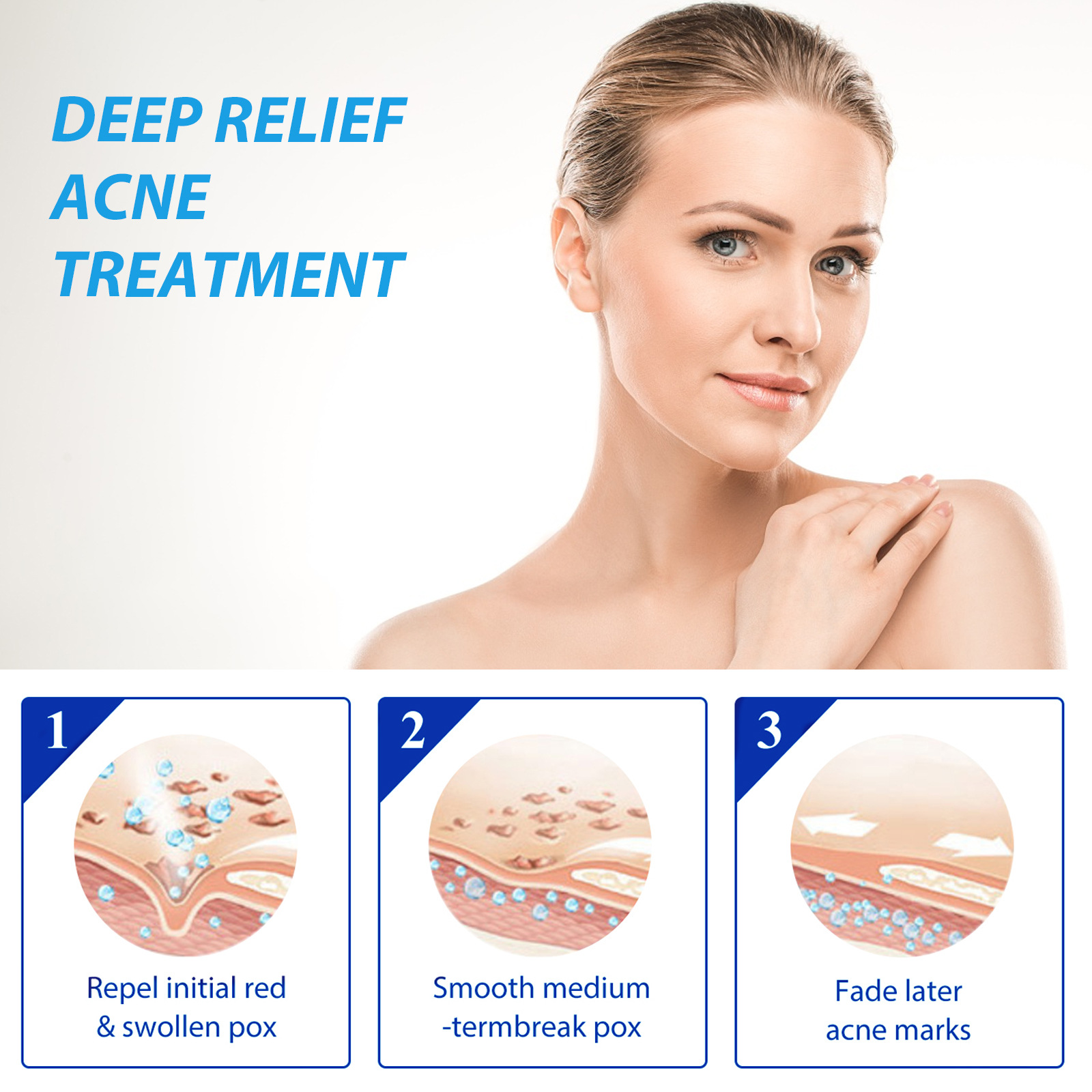 EELHOE Acne Behandeling Lotion - Salicylic Acid Blackhead Remover recensie en prijs